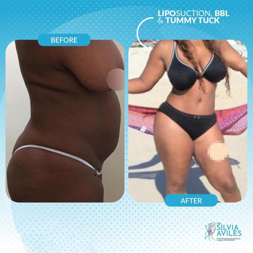 Slider image (9) Dra. Silvia Aviles